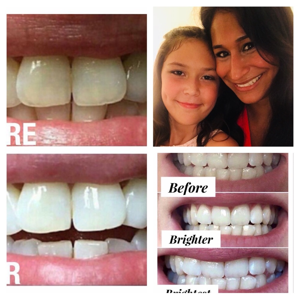 Toothpaste